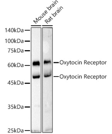 Oxytocin Receptor Rabbit Polyclonal Antibody
