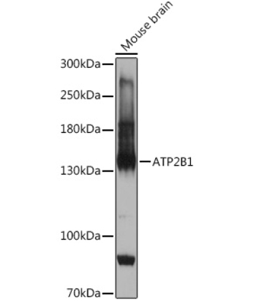 ATP2B1 Rabbit Polyclonal Antibody