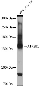 ATP2B1 Rabbit Polyclonal Antibody
