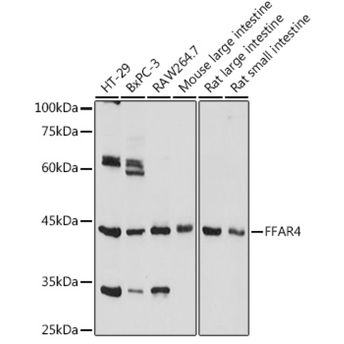 FFAR4 Rabbit Polyclonal Antibody