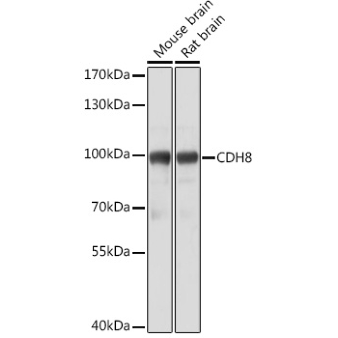 CDH8 Rabbit Polyclonal Antibody