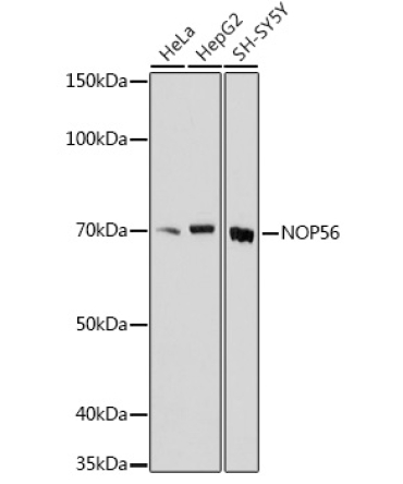 NOP56 Rabbit Polyclonal Antibody