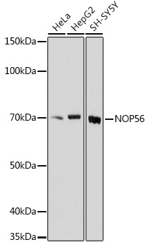 NOP56 Rabbit Polyclonal Antibody