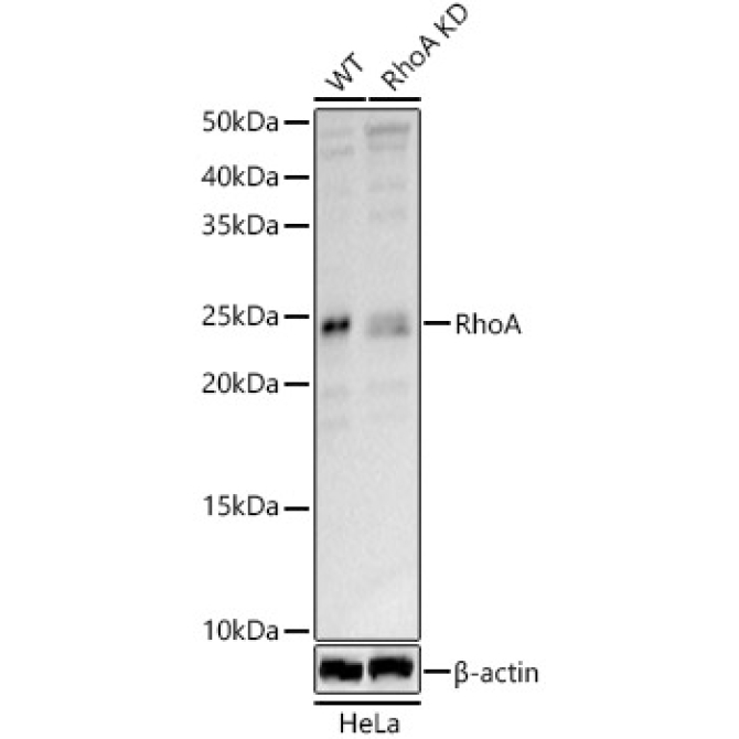 RhoA Rabbit Polyclonal Antibody [KD Validated]