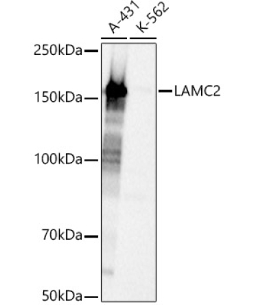 LAMC2 Rabbit Polyclonal Antibody