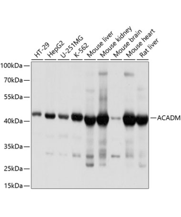 ACADM Rabbit Polyclonal Antibody