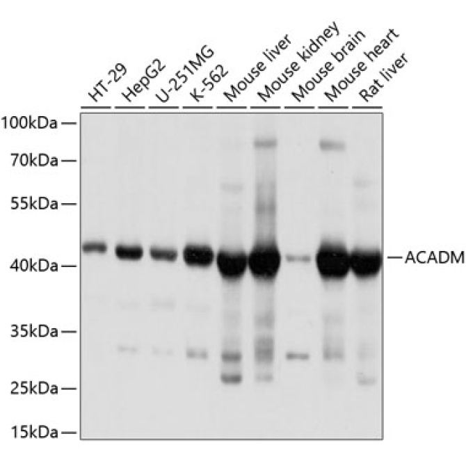 ACADM Rabbit Polyclonal Antibody