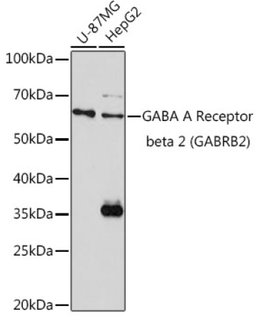 GABA A Receptor beta 2 (GABRB2) Rabbit Polyclonal Antibody