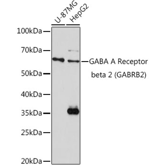 GABA A Receptor beta 2 (GABRB2) Rabbit Polyclonal Antibody