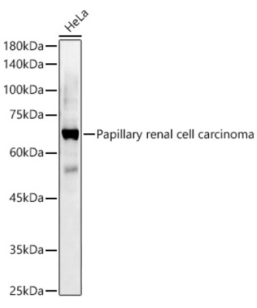 Papillary renal cell carcinoma Rabbit Polyclonal Antibody