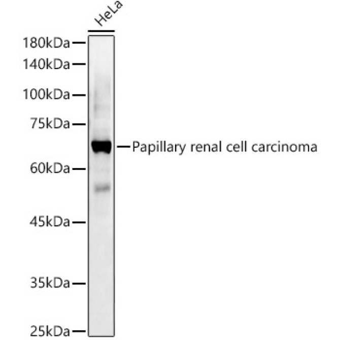 Papillary renal cell carcinoma Rabbit Polyclonal Antibody