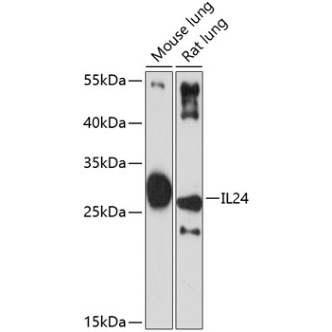 IL24 Rabbit Polyclonal Antibody
