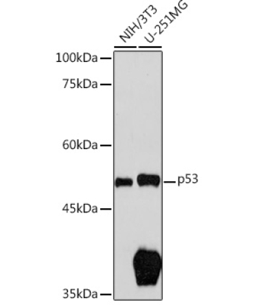 p53 Rabbit Polyclonal Antibody