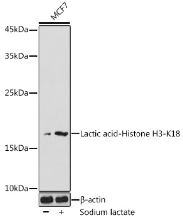 Lactic acid-Histone H3-K18 Rabbit Polyclonal Antibody