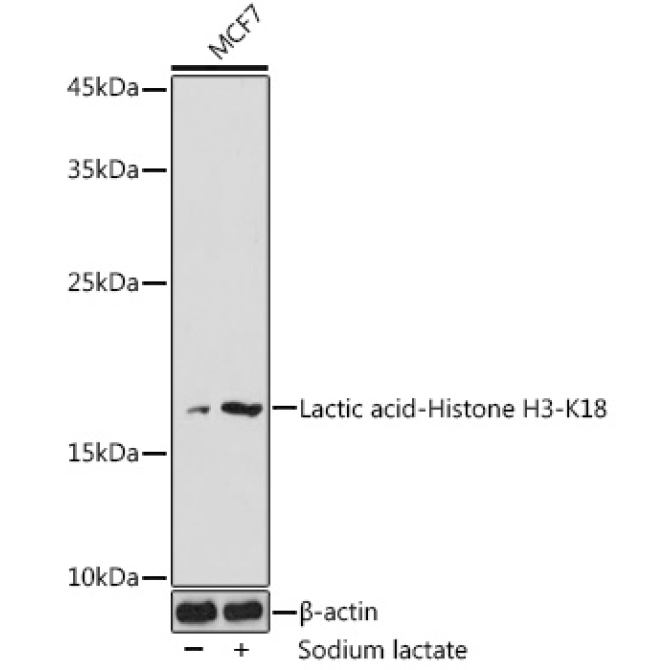 Lactic acid-Histone H3-K18 Rabbit Polyclonal Antibody