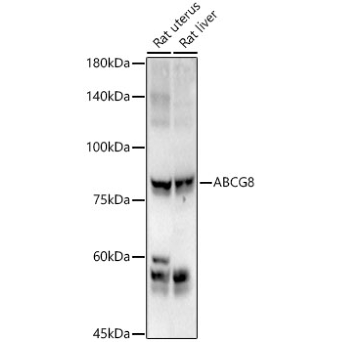 ABCG8 Rabbit Polyclonal Antibody