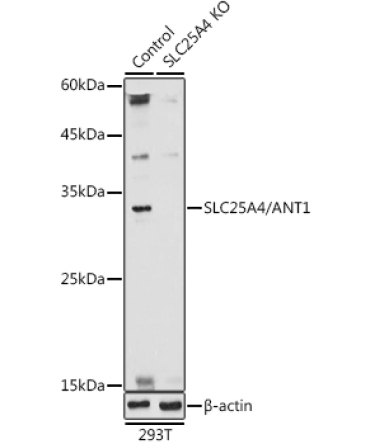 SLC25A4/ANT1 Rabbit Polyclonal Antibody [KO Validated]