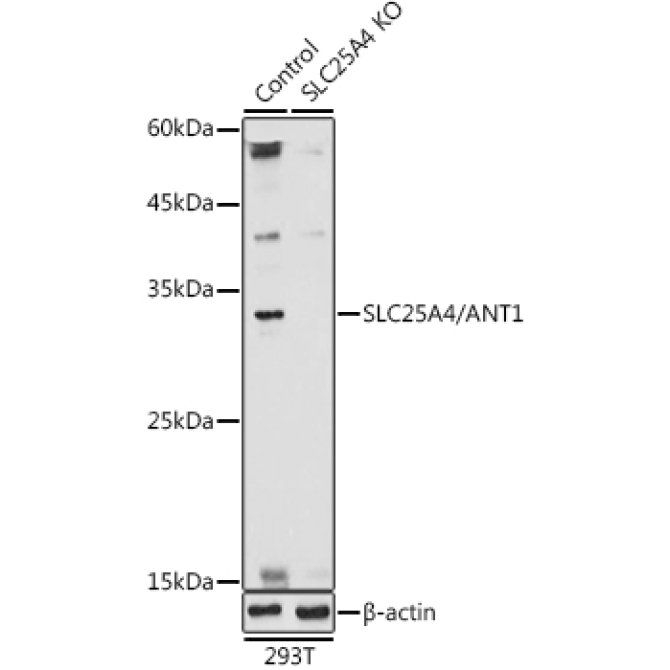 SLC25A4/ANT1 Rabbit Polyclonal Antibody [KO Validated]