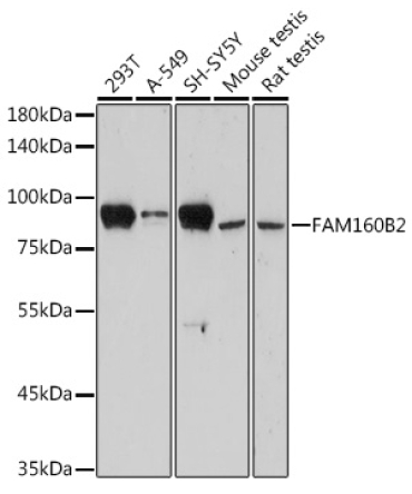 FAM160B2 Rabbit Polyclonal Antibody