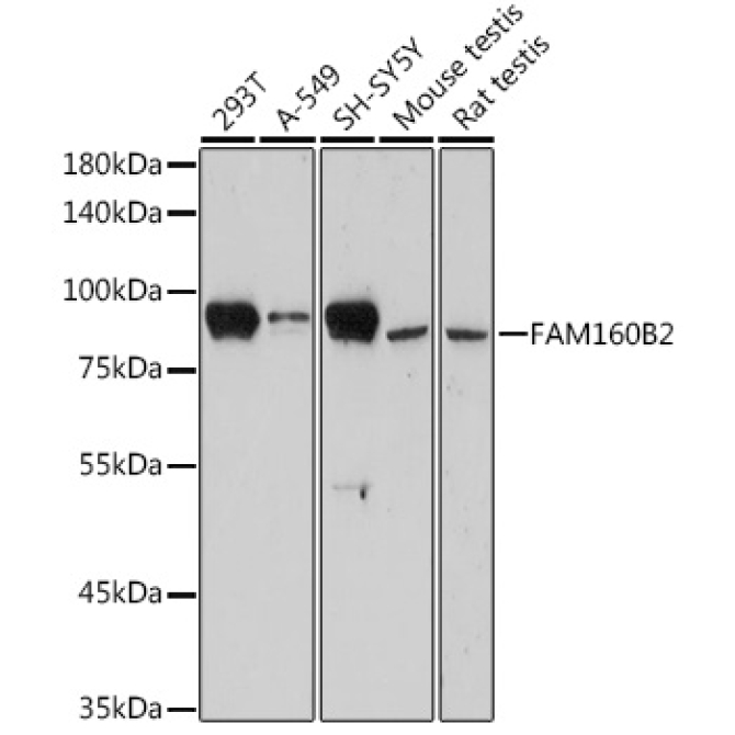 FAM160B2 Rabbit Polyclonal Antibody