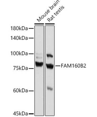 FAM160B2 Rabbit Polyclonal Antibody