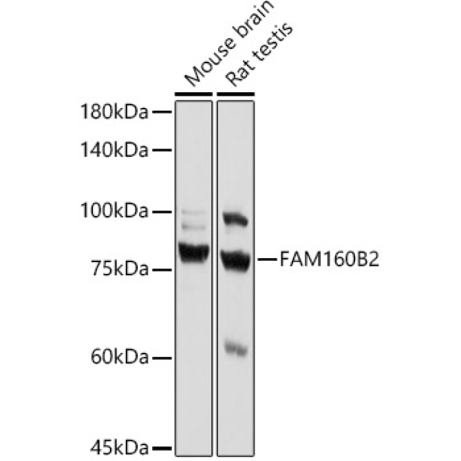 FAM160B2 Rabbit Polyclonal Antibody