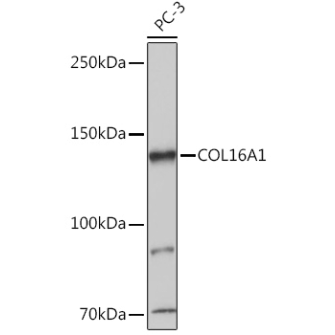 COL16A1 Rabbit Polyclonal Antibody