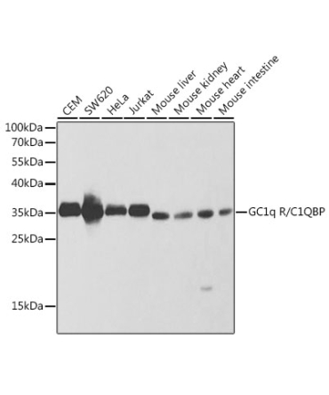 GC1q R/C1QBP Rabbit Polyclonal Antibody