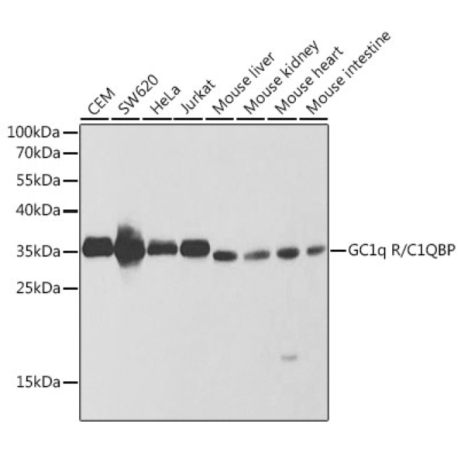 GC1q R/C1QBP Rabbit Polyclonal Antibody