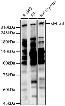 KMT2B Rabbit Polyclonal Antibody