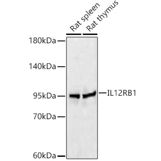 IL12RB1 Rabbit Polyclonal Antibody
