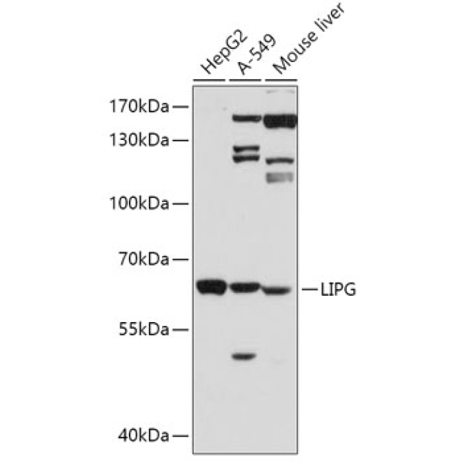 LIPG Rabbit Polyclonal Antibody