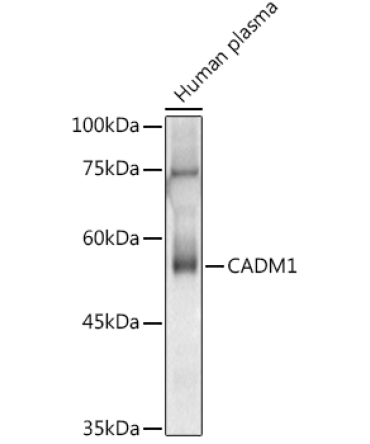 CADM1 Rabbit Polyclonal Antibody