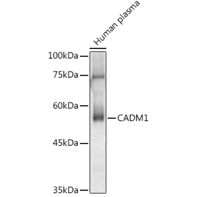 CADM1 Rabbit Polyclonal Antibody