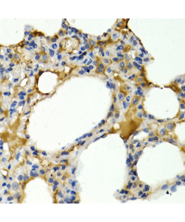 IL9 Rabbit Polyclonal Antibody