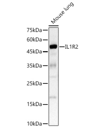 IL1R2 Rabbit Polyclonal Antibody