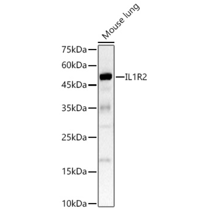 IL1R2 Rabbit Polyclonal Antibody