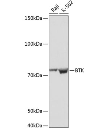 BTK Rabbit Monoclonal Antibody