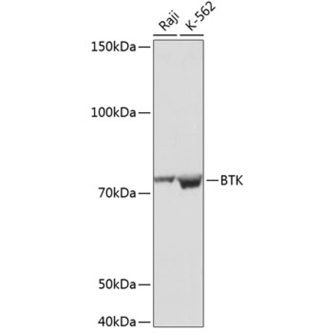 BTK Rabbit Monoclonal Antibody