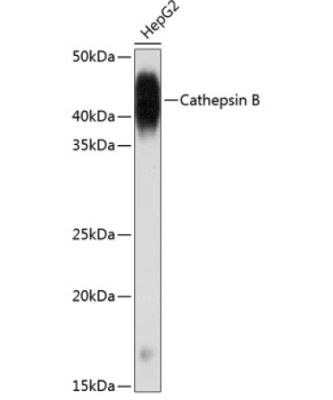 Cathepsin B Rabbit Monoclonal Antibody