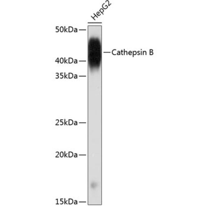 Cathepsin B Rabbit Monoclonal Antibody
