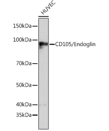 CD105/Endoglin Rabbit Monoclonal Antibody