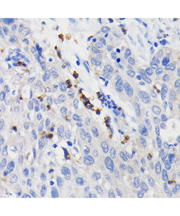 CD11b/ITGAM Rabbit Monoclonal Antibody