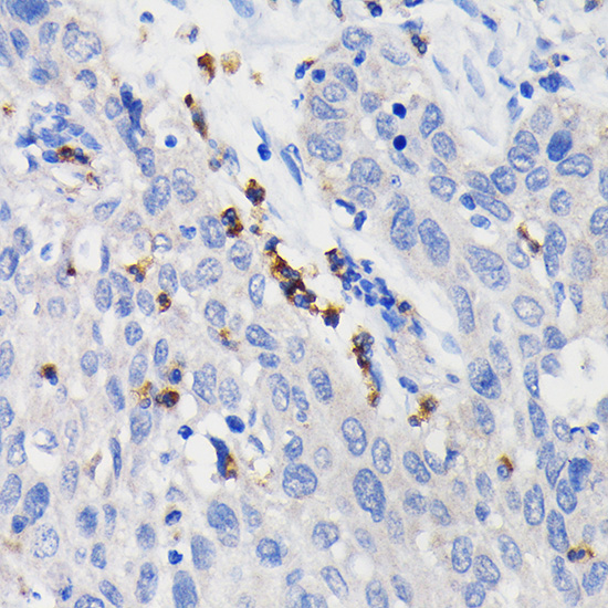 CD11b/ITGAM Rabbit Monoclonal Antibody