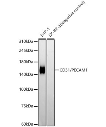 CD31/PECAM1 Rabbit Monoclonal Antibody