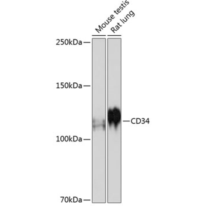 CD34 Rabbit Monoclonal Antibody