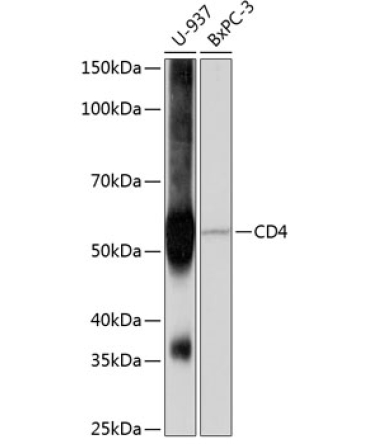 CD4 Rabbit Monoclonal Antibody