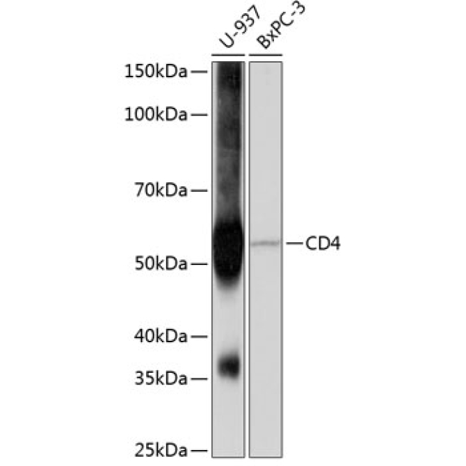 CD4 Rabbit Monoclonal Antibody