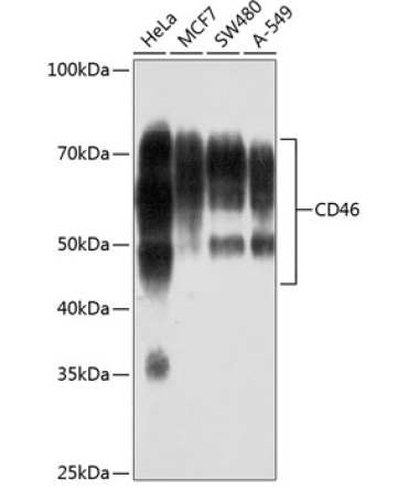 CD46 Rabbit Monoclonal Antibody