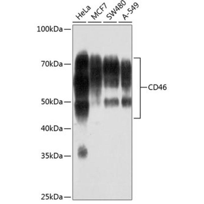 CD46 Rabbit Monoclonal Antibody